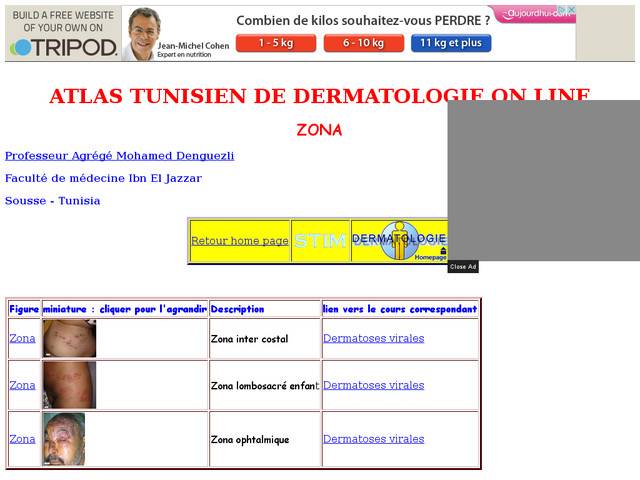 Atlas tunisien de dermatologie on line