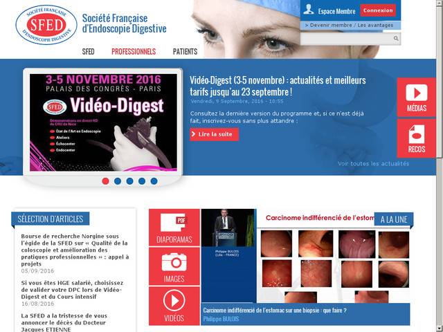 Société française d'endoscopie digestive.