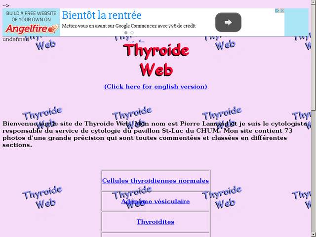 Thyroide web.
