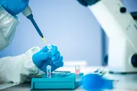 Abivax obtient le feu vert de la FDA pour le lancement d’essais cliniques avec ABX464 dans le traitement de la Rectocolite Hémorragique Modérée à Sévère