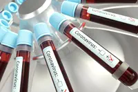 Le test moléculaire Novodiag® détectera le coronavirus et la grippe en 30 minutes