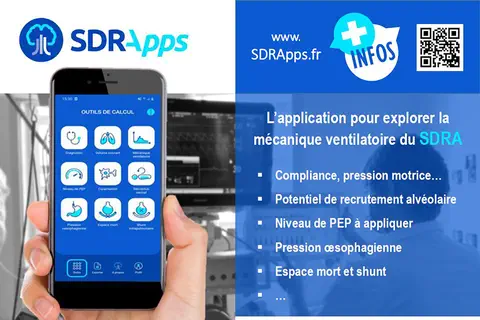 SDRApps, une nouvelle application pour les professionnels de réanimation