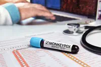 Monkeypox : les médecins de plus en plus préoccupés par la désinformation