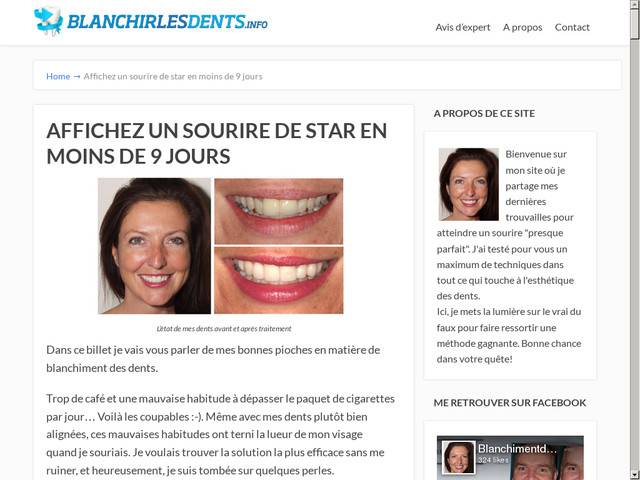 Blanchirlesdents.info - en finir avec les dents qui manquent d'éclat