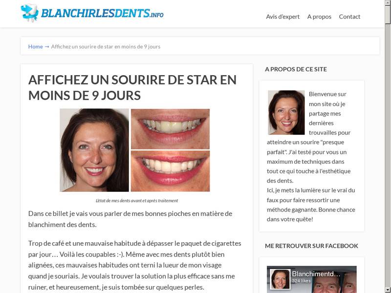 BlanchirLesDents.info - En finir avec les dents qui manquent d'éclat