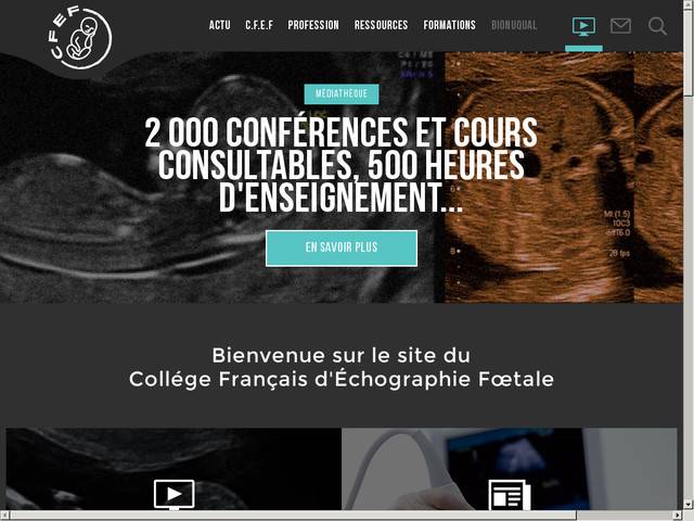 College français d'echographie foetale
