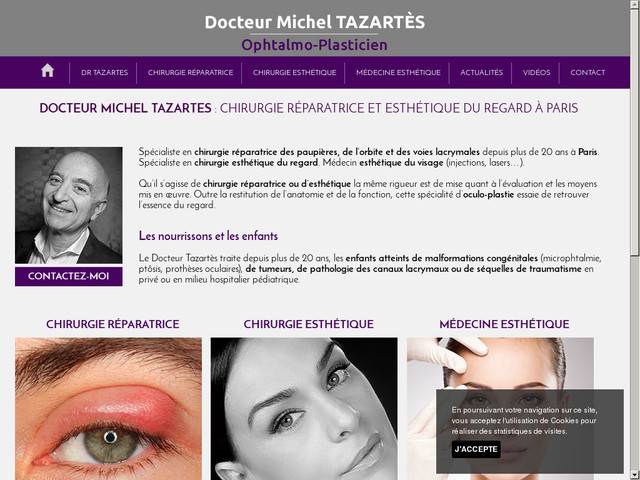 Chirurgien tazartes 