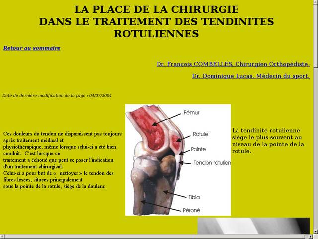 La place de la chirurgie dans le traitement des 
tendinites rotuliennes