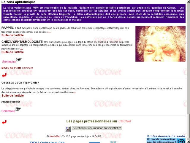 Le zona ophtalmique