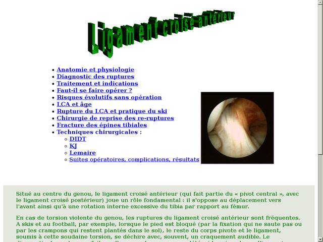 Ligament croisé antérieur