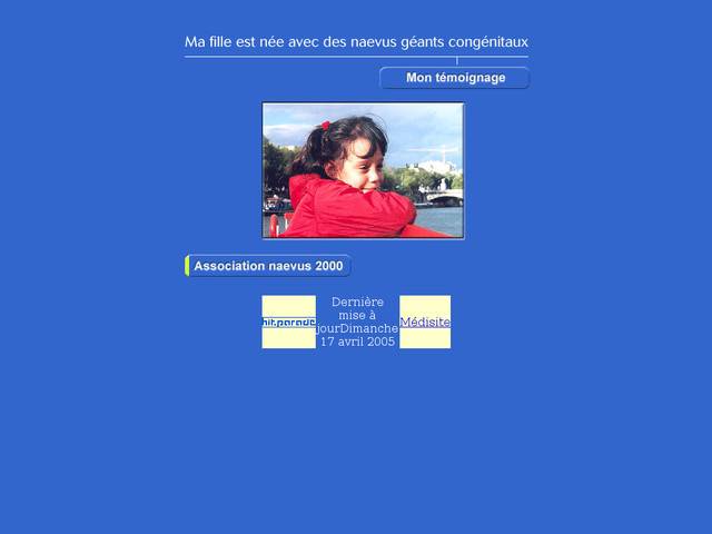Naevus géant congénital : témoignage d'une maman 
adhérente de l'association naevus 2000.