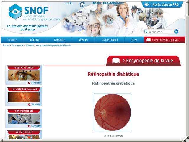 Rétinopathie diabétique