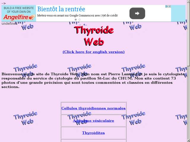 Thyroide web.