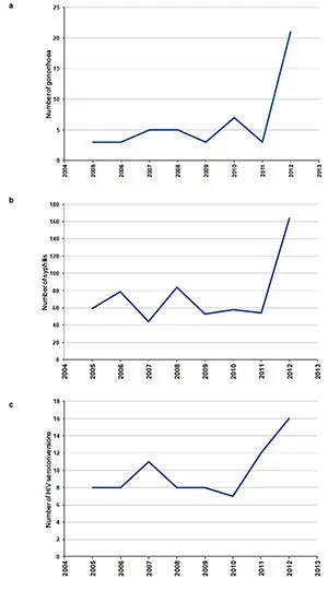 APHM : augmentation des gonococcies, de la syphilis et des primo-infections par le VIH en 2012