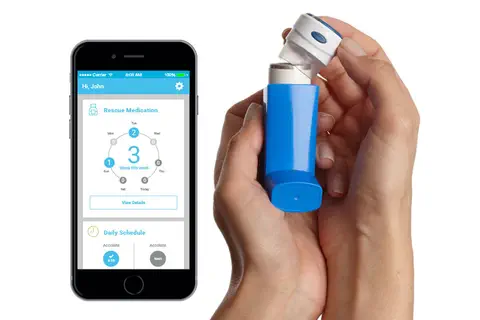 Asthme : un inhalateur intelligent permet de réduire la fréquence des crises