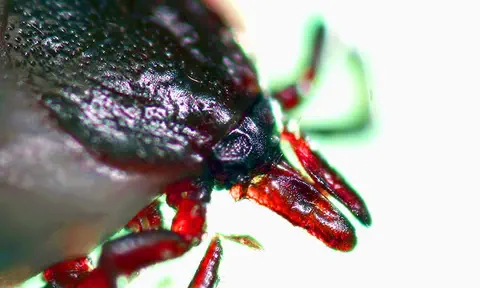La maladie de Lyme
