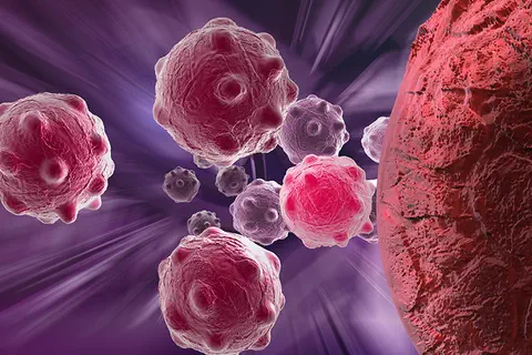 Tumeurs neuroendocrines gastro-entéro-pancréatiques : le Lutathera mis sur le marché européen