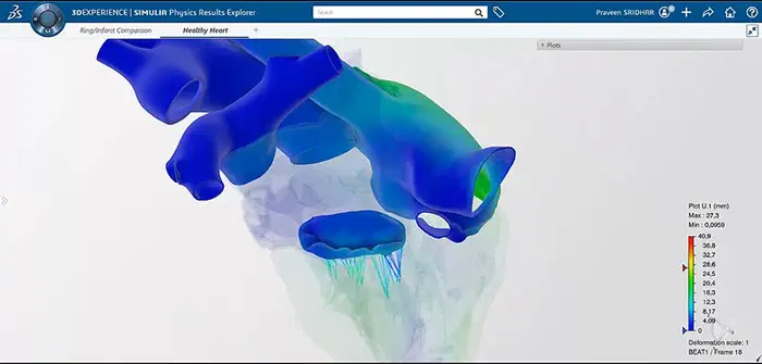 Cœurs personnalisés simulés en 3D : le projet Living Heart de Dassault Systèmes accessible dans le cloud 