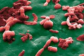 La prise d'antibiotique réduit l'efficacité de l’immunothérapie