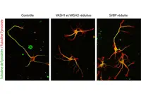 Une enzyme cruciale pour les neurones enfin démasquée