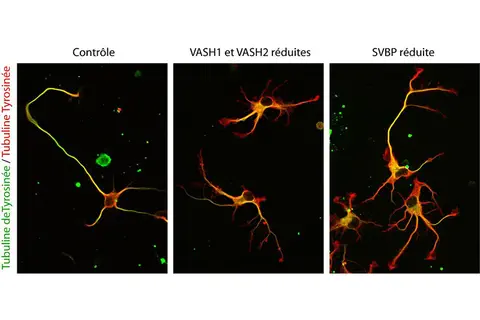 Une enzyme cruciale pour les neurones enfin démasquée