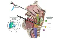 Chirurgie assistée par robot, Gustave Roussy signe une première européene en orl