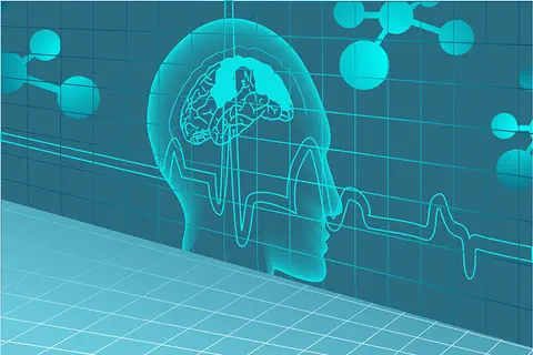 Maladie de Parkinson : la Bumétanide atténue la sévérité du syndrome 