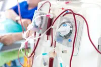UniHA a lancé le premier marché national sous forme de forfait d’hémodialyse en coût à la séance