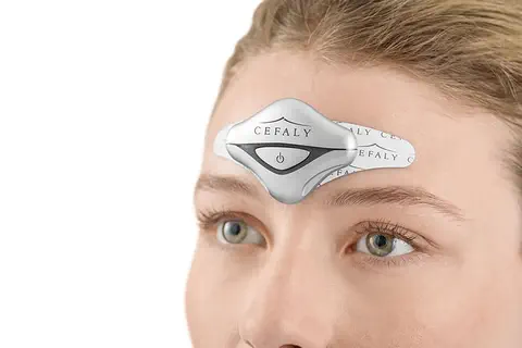 Le Traitement de la migraine par neurostimulation crânienne externe validé dans une étude de phase 3