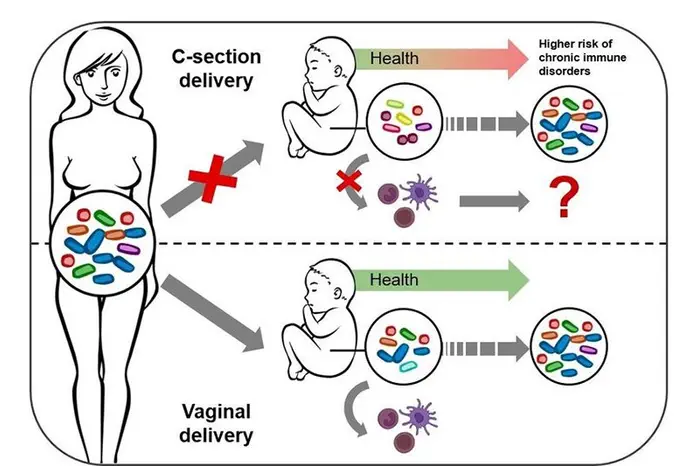 L'accouchement par césarienne perturbe la transmission de bactéries importantes pour la stimulation du système immunitaire de l'enfant