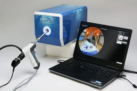 Traitement de l’adénome de la prostate avec le REZUM