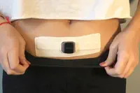 ALVALUX CHOISIT LA FRANCE POUR LANCER SON DISPOSITIF WEARABLE DE TRAITEMENT DES CICATRICES POUR LA SANTÉ DES FEMMES