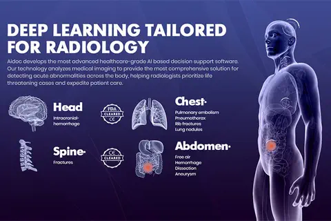 Aidoc annonce le marquage CE pour le premier outil pour le workflow basé sur l’IA pour les embolies pulmonaires