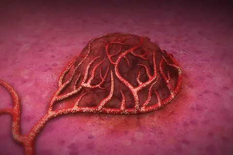 Cancer du foie inopérable : un nouveau traitement remboursé par l’assurance maladie