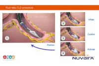 Nuvaira obtient un financement d’innovation en France pour son étude pivot AIRFLOW-3