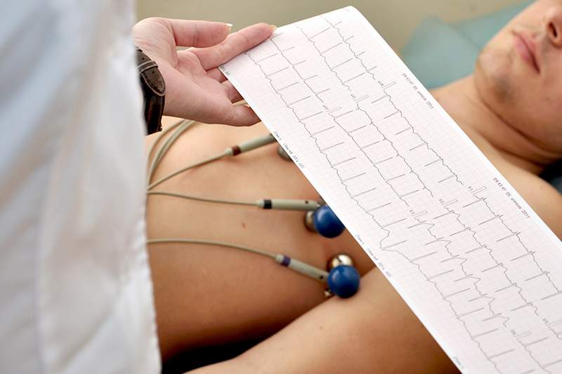 Arythmie cardiaque : une approche nouvelle