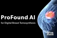 #IA ProFound AI™, le seul logiciel d’intelligence artificielle qui a cliniquement démontré sa capacité à améliorer le dépistage du cancer du sein sera présenté aux JFR