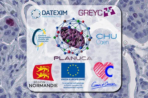 Dépistage précoce des cancers du col de l’utérus dans la Manche