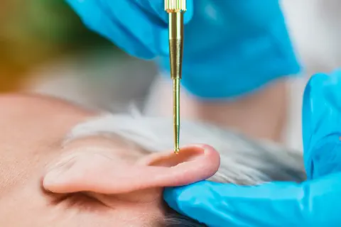 Médecines douces : la répression des fraudes épingle 68 % des praticiens contrôlés