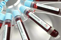 #Coronavirus : 2,3 % de mortalité et 1 % de patients asymptomatiques selon une étude chinoise sur 72 000 cas