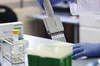 BIOTECON Diagnostics conclut un accord de distribution exclusif pour fournir des tests de dépistage du coronavirus à la plupart des marchés du monde