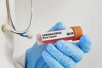 Le test antigénique VITROS® SARS-CoV-2 d’Ortho Clinical Diagnostics à haute cadence obtient le marquage CE