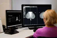 NorthShore University HealthSystem intègre la plateforme d’intelligence artificielle révolutionnaire densitas® intelliMammo™ pour le dépistage de précision du cancer du sein