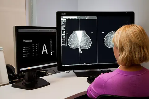 NorthShore University HealthSystem intègre la plateforme d’intelligence artificielle révolutionnaire densitas® intelliMammo™ pour le dépistage de précision du cancer du sein