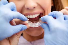 L’orthodontie moderne chez l’adulte : ses spécificités et bénéfices pour la santé
