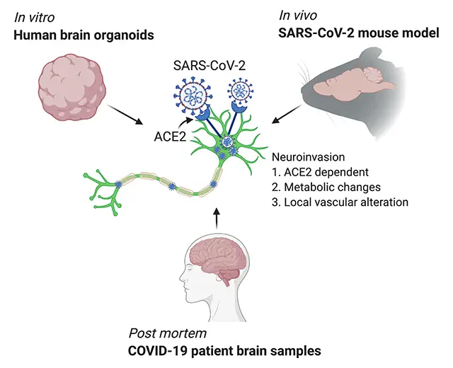 Le coronavirus SARS-CoV-2 peut infecter les neurones selon une étude franco-américaine