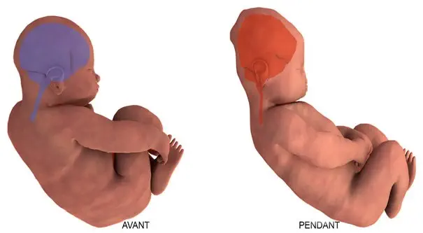 La rencontre des parents, des naissants, et des sachants : plaidoyer pour une médecine au service du « bien-naître »