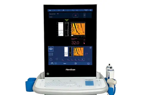 Le dépistage non invasif de la fibrose hépatique par FibroScan® étendu désormais aux IDE