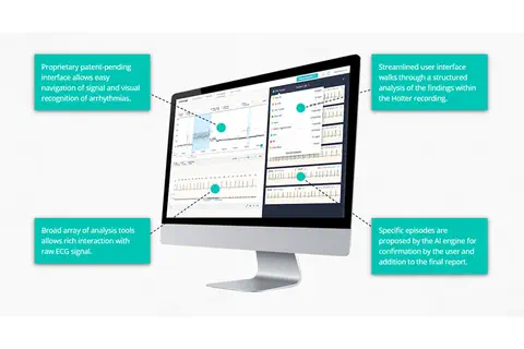 L’IA fait gagner du temps aux cardiologues sur l’analyse d’ECG longue durée