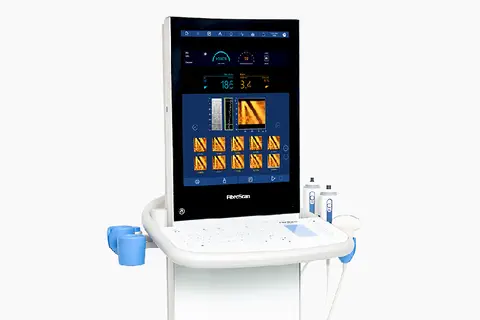 Echosens met en lumière les nouvelles directives de l’EASL pour la pratique clinique : une recommandation sans précédent pour la gestion des soins et des FibroScan non invasifs